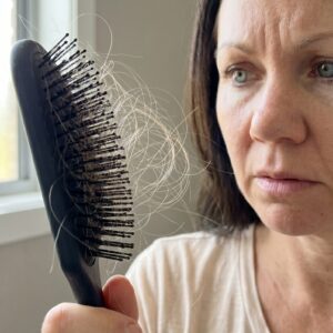 Alopecia y Mantequilla de Karite