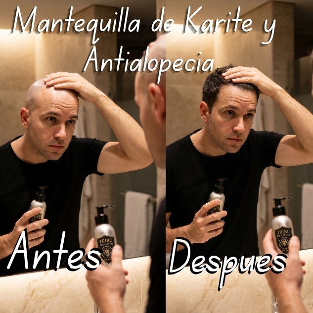 beneficios de Alopecia y Mantequilla de Karite