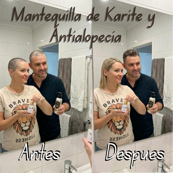 caída del cabello,